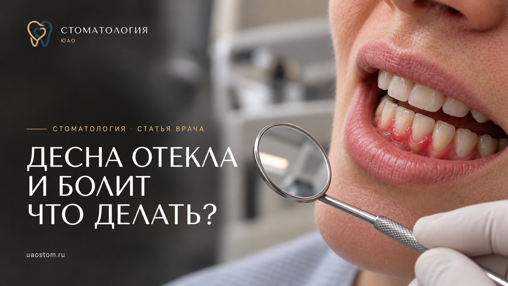 Обложка статьи «Десна отекла и болит: что делать?»